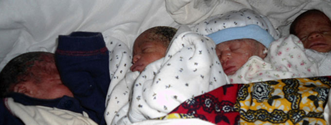 Quadruplets born in rural DRC, with help of emergency obstetric programme