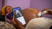 Los aparatos portátiles de ultrasonido traen un rayo de esperanza a las embarazadas en medio de la crisis en la República Democrática del Congo