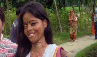 Working to End Acid Attacks in Bangladesh by 2015